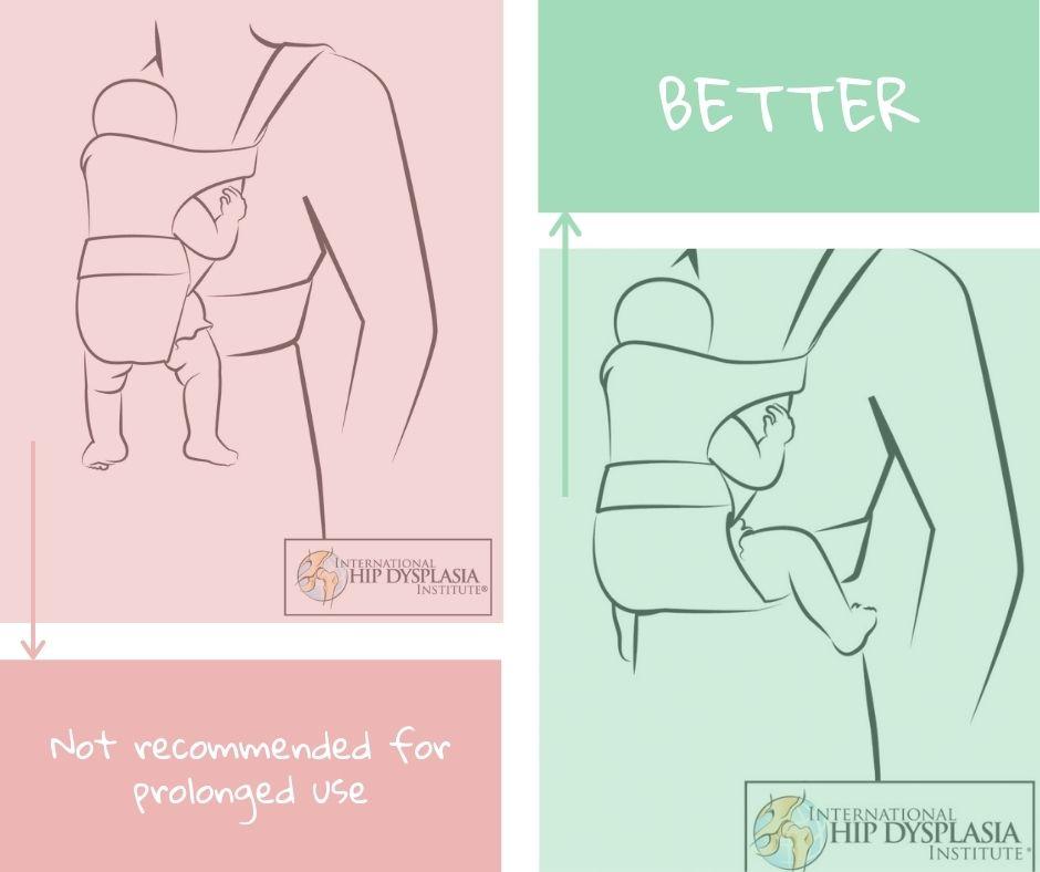 Can a Baby Carrier Cause Hip Problems? Essential Facts Revealed